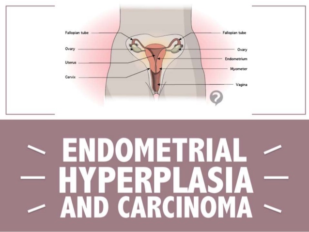 endometrial hyperplasia and carcinoma 1 638